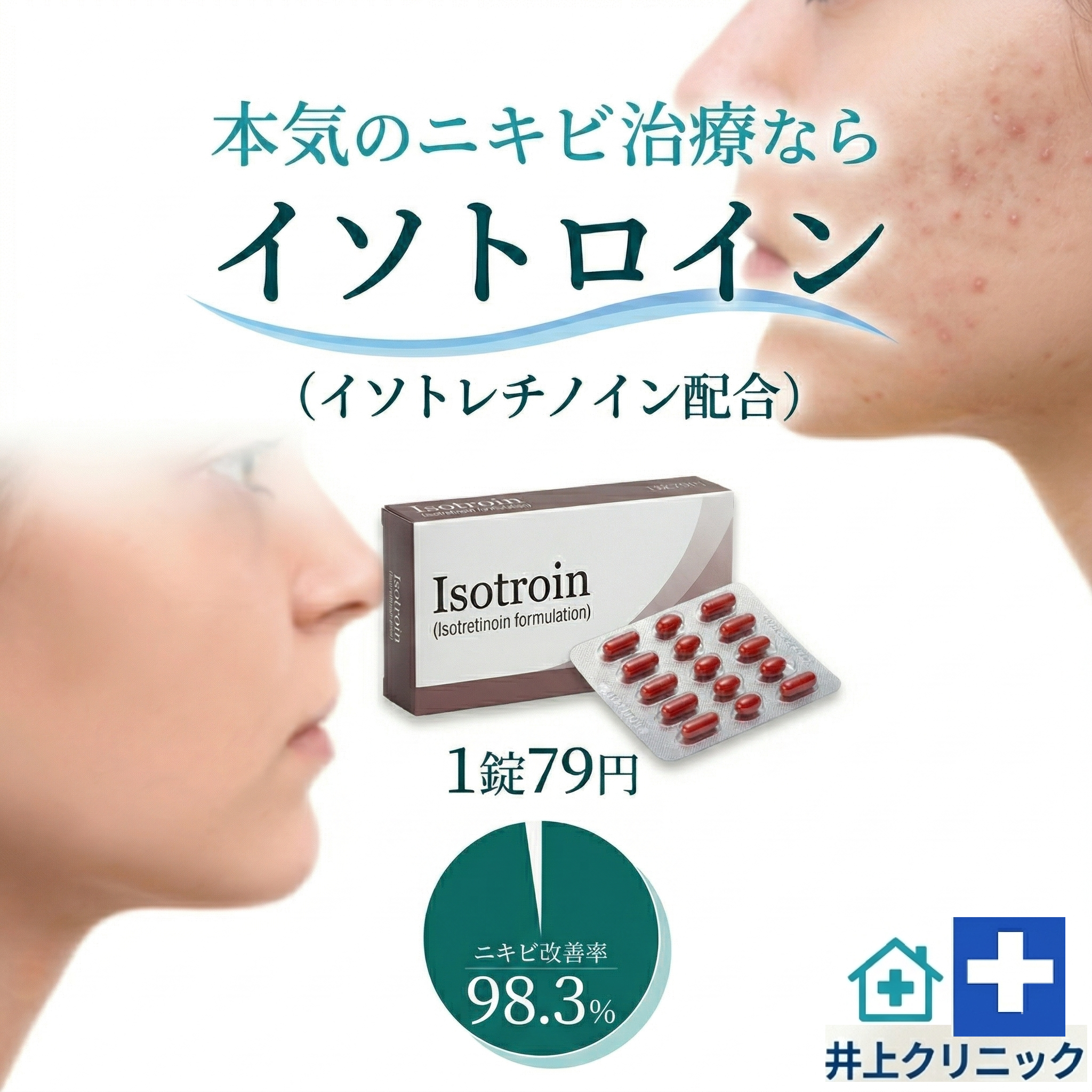 本気のニキビ治療ならイソトロイン（イソトレチノイン配合）1錠79円 いのうえクリニック